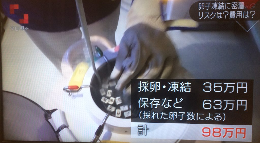 卵子凍結
