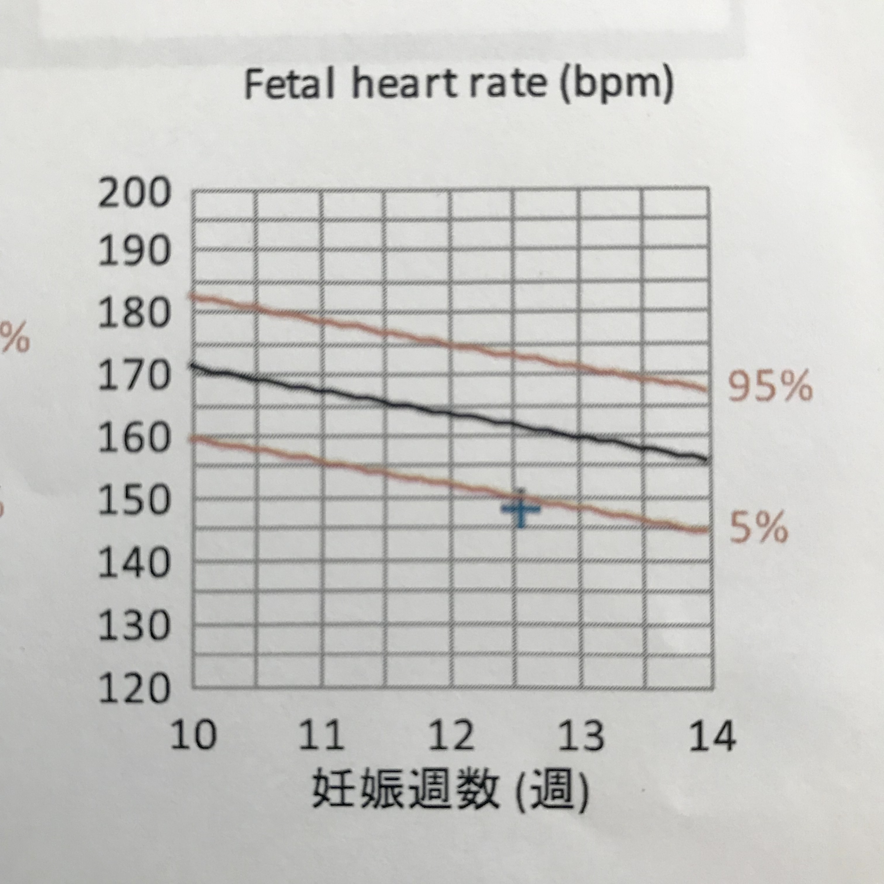 FMC東京クリニック コンバインドプラス検査 胎児ドック