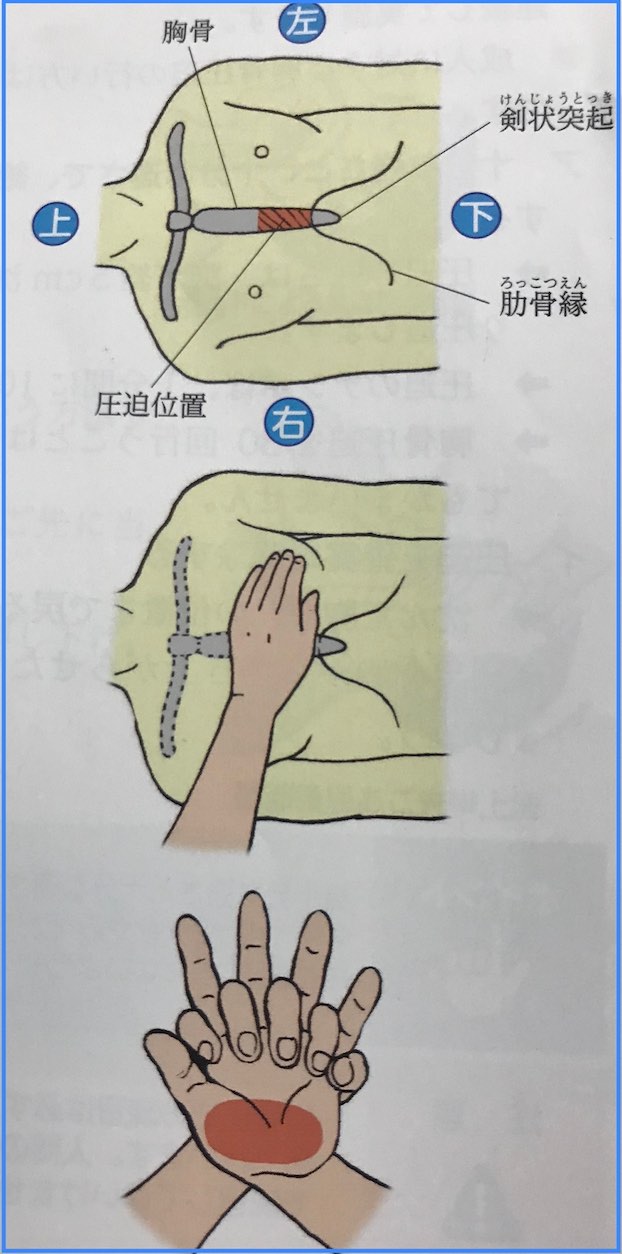 胸骨圧迫